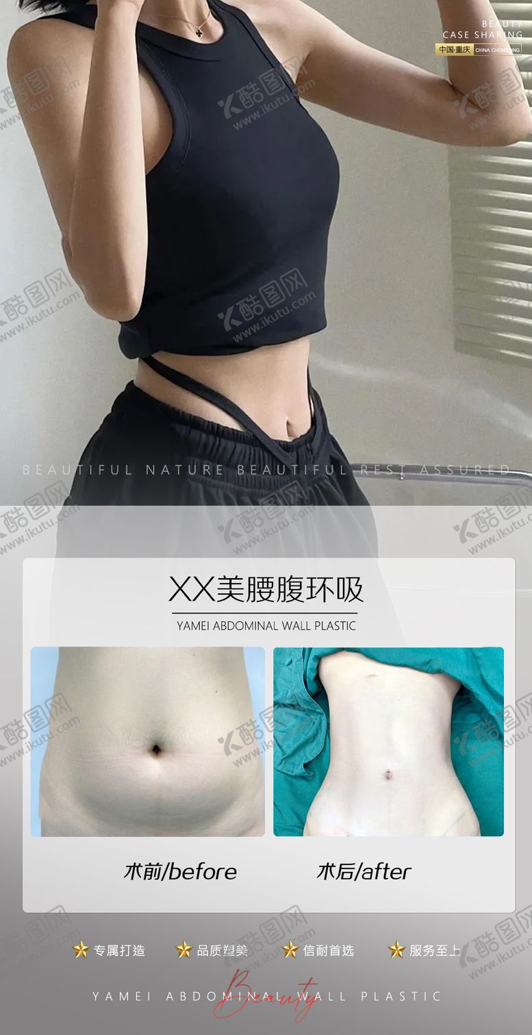 编号：27679411231027038177【酷图网】源文件下载-医美案例腰腹环吸海报