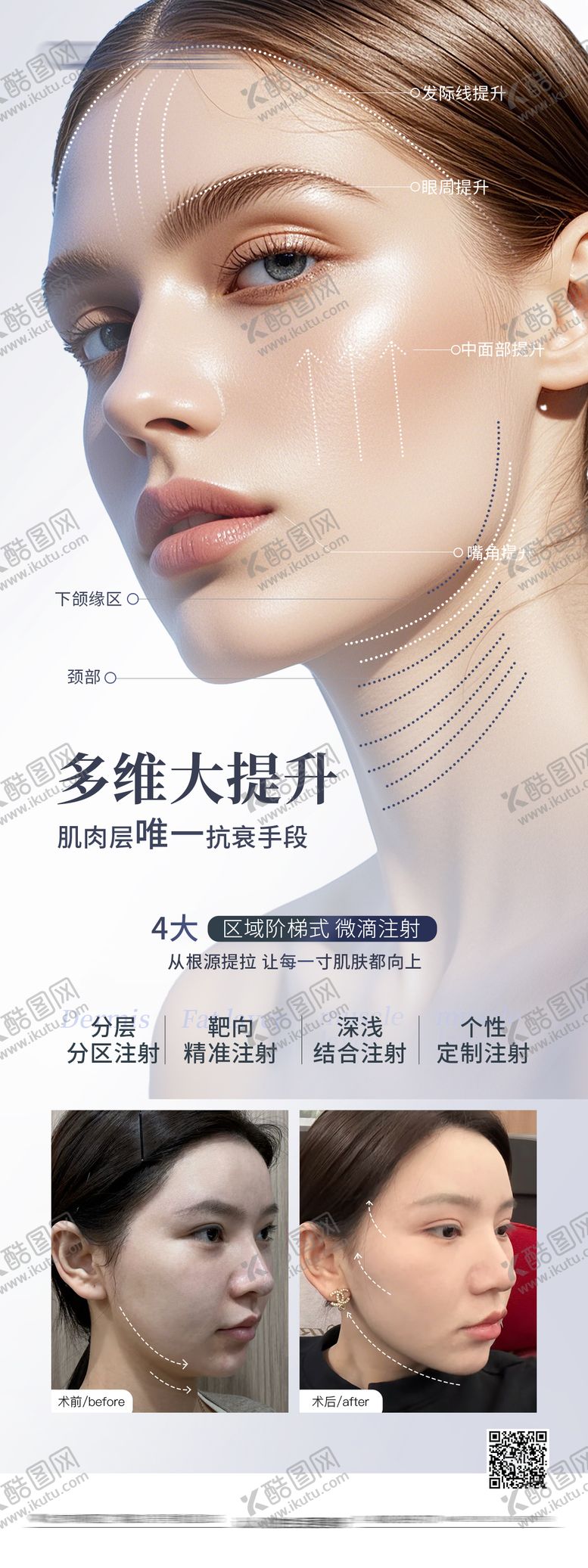 编号：41868111301857354438【酷图网】源文件下载-面部提升案例对比海报