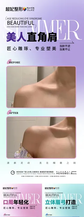 微整案例