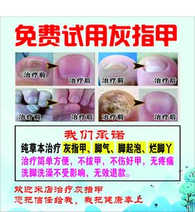 编号：08916709270647092904【酷图网】源文件下载-灰指甲