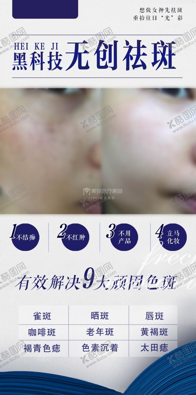 编号：89041309280007404598【酷图网】源文件下载-祛斑