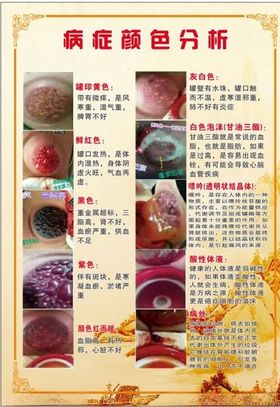 春草拔罐