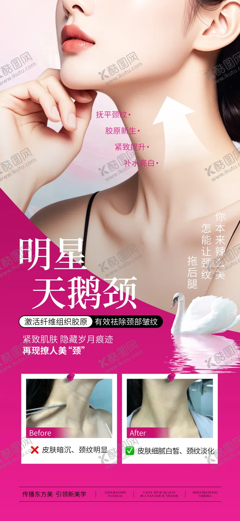 编号：11260402151105441913【酷图网】源文件下载-医美天鹅颈案例宣传海报