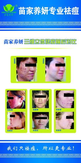 去痘对比