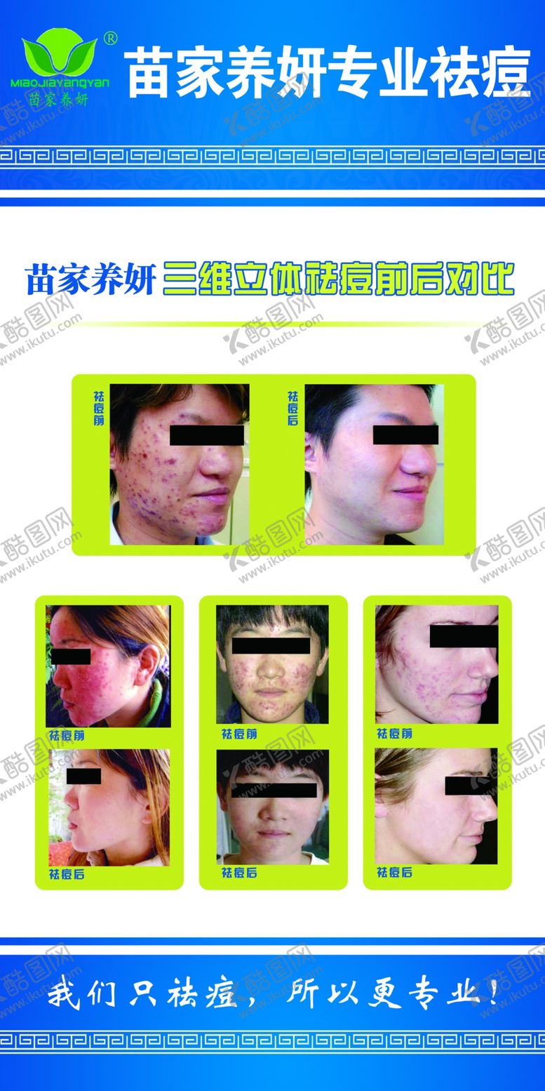 编号：32757509300028324206【酷图网】源文件下载-祛痘前后对比图