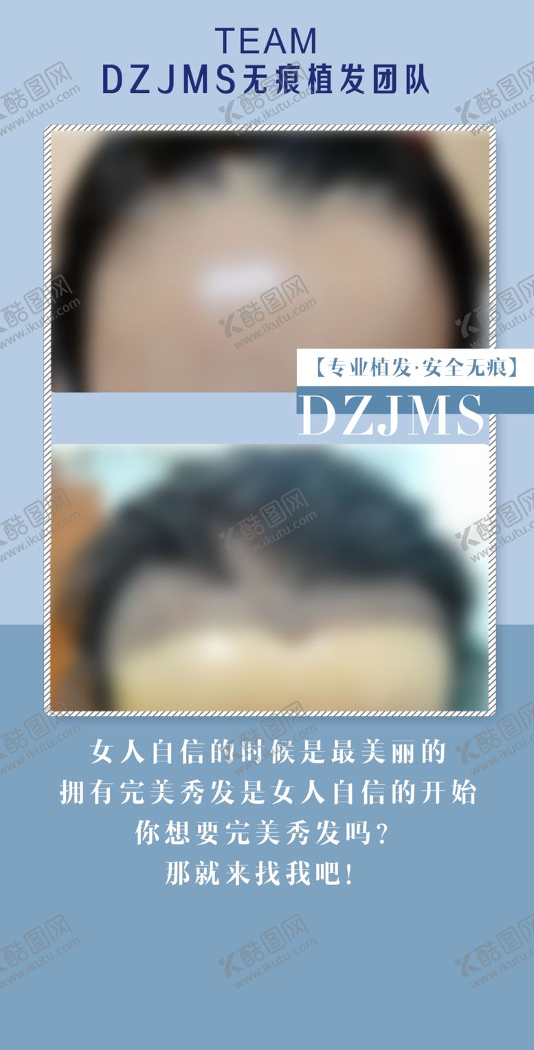 编号：44269207071502284185【酷图网】源文件下载-植发
