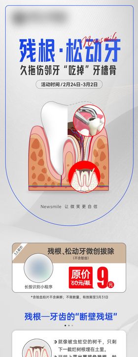 残根松动牙招募海报长图