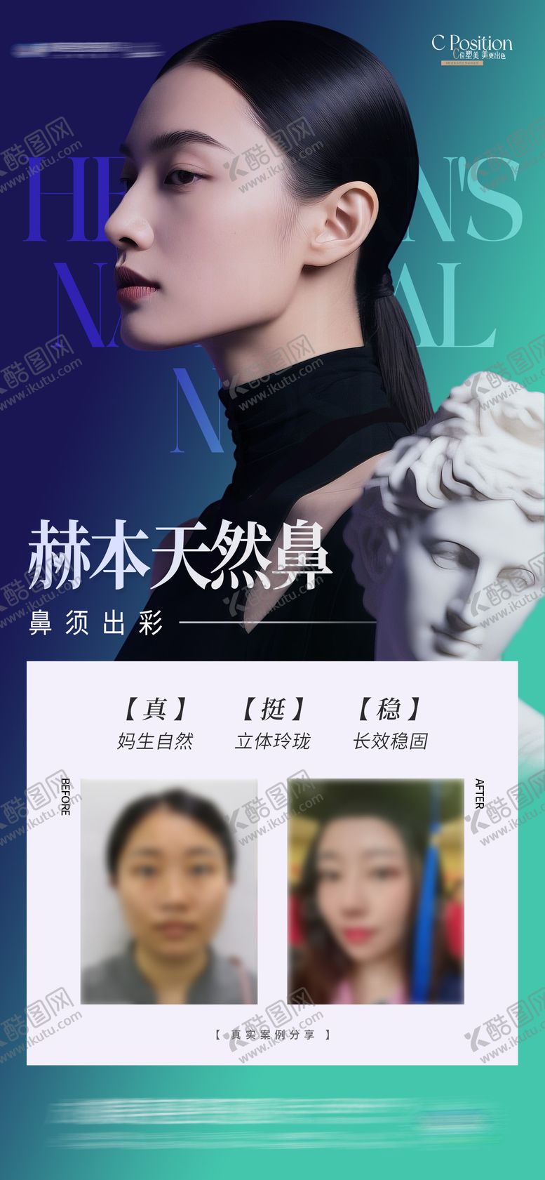 编号：20835010301836453016【酷图网】源文件下载-医美赫本天然鼻隆鼻案例海报
