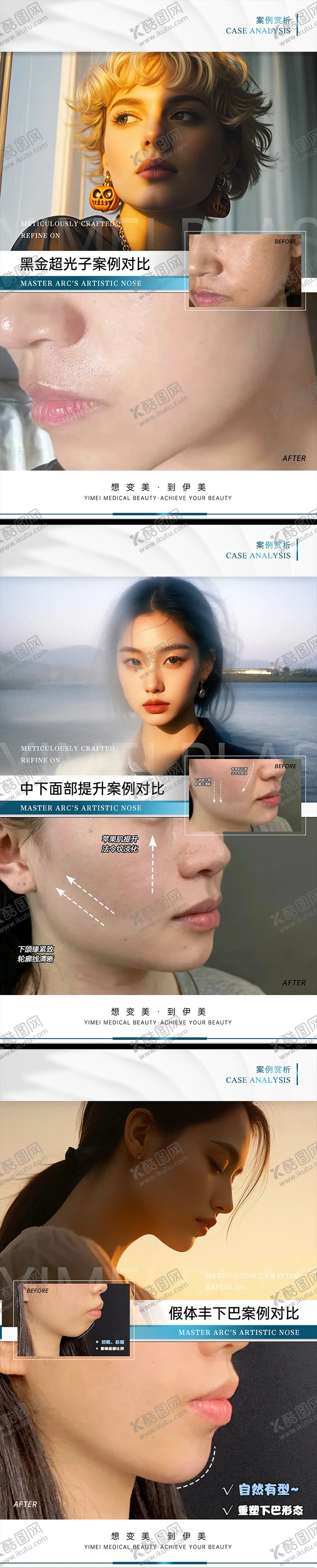 编号：16471702211348162429【酷图网】源文件下载-医美案例对比模板