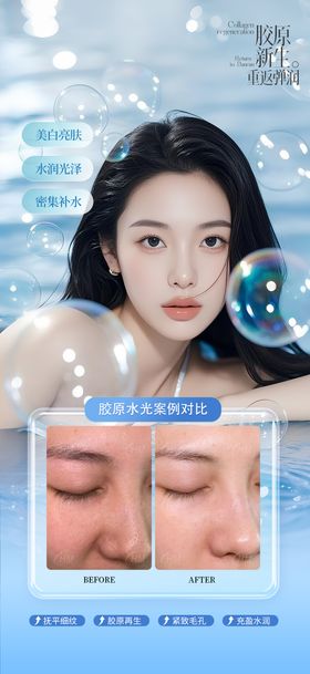 胶原水光案例海报