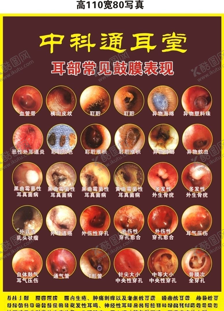 编号：40155310210249571966【酷图网】源文件下载-常见鼓膜表现症状图灯箱