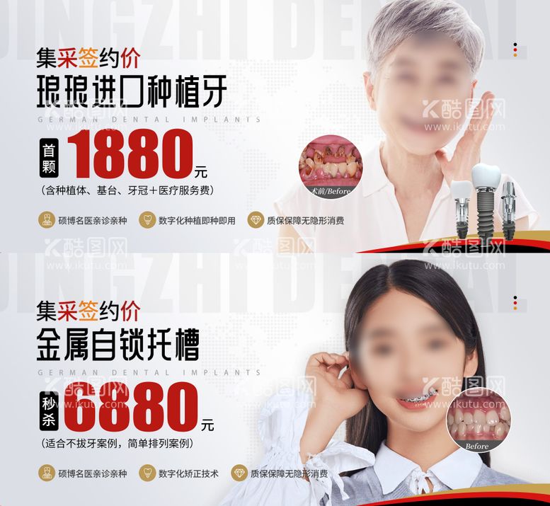 编号：92308311251254126482【酷图网】源文件下载-种植牙矫正活动banner