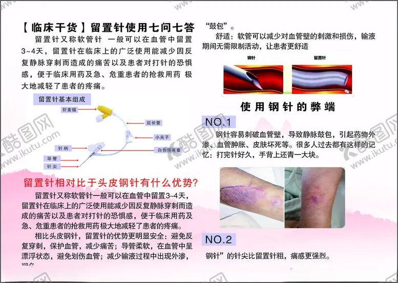 编号：30710902152326084721【酷图网】源文件下载-留置针使用