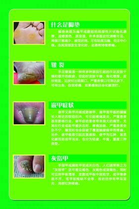 脚垫安全使用指南长图