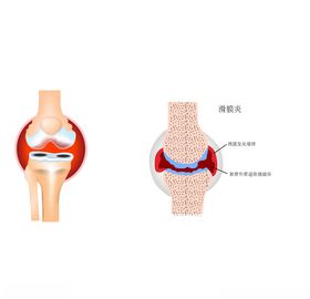 滑膜