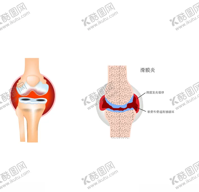 编号：56079107020641101703【酷图网】源文件下载-滑膜
