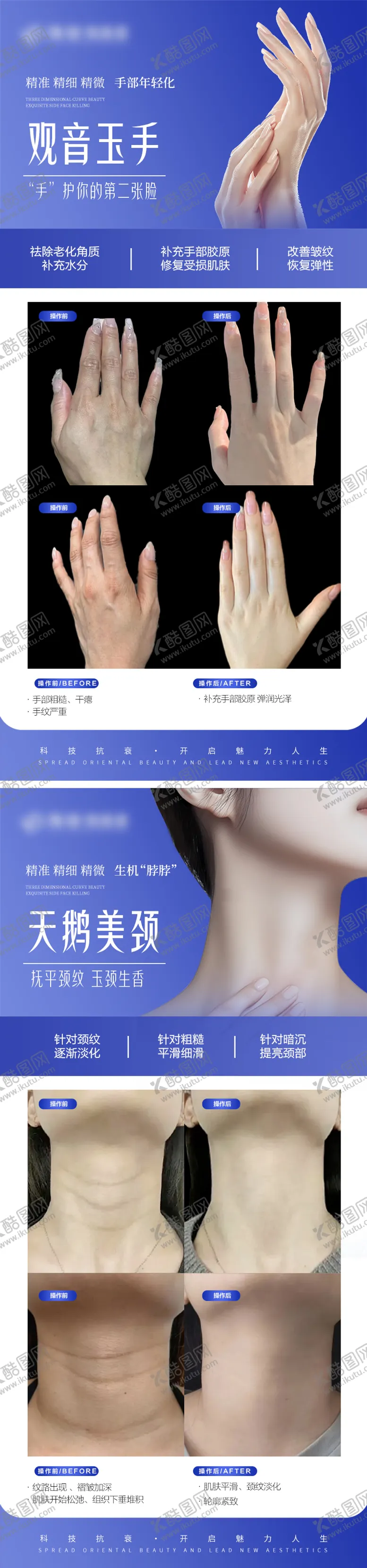 编号：18448602141451108918【酷图网】源文件下载-医美手部颈部抗衰案例对比宣传系列海报