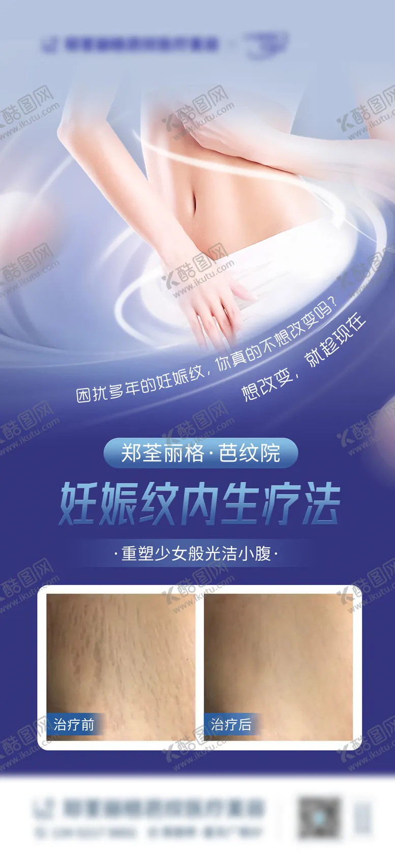 编号：18364811211046518846【酷图网】源文件下载-妊娠纹医美移动端海报