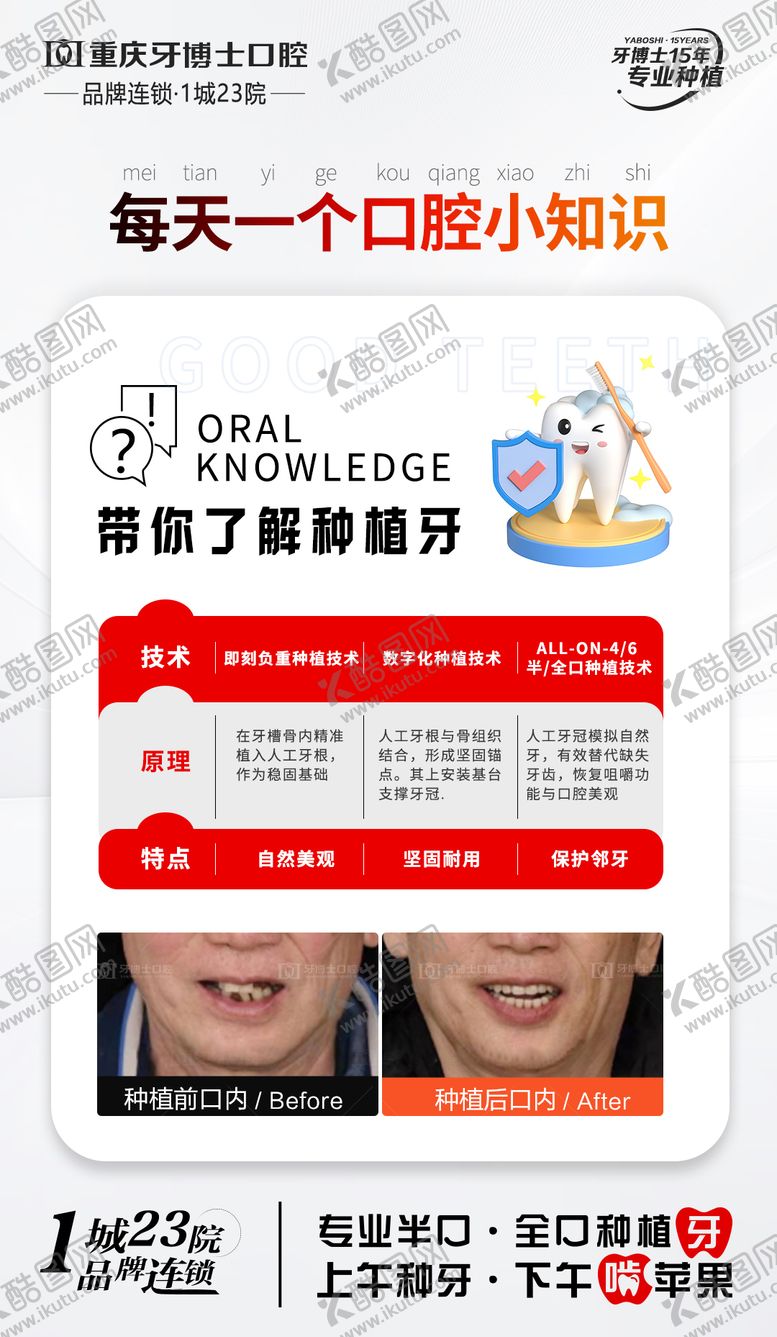 编号：16673504170504027065【酷图网】源文件下载-口腔种植牙科普知识
