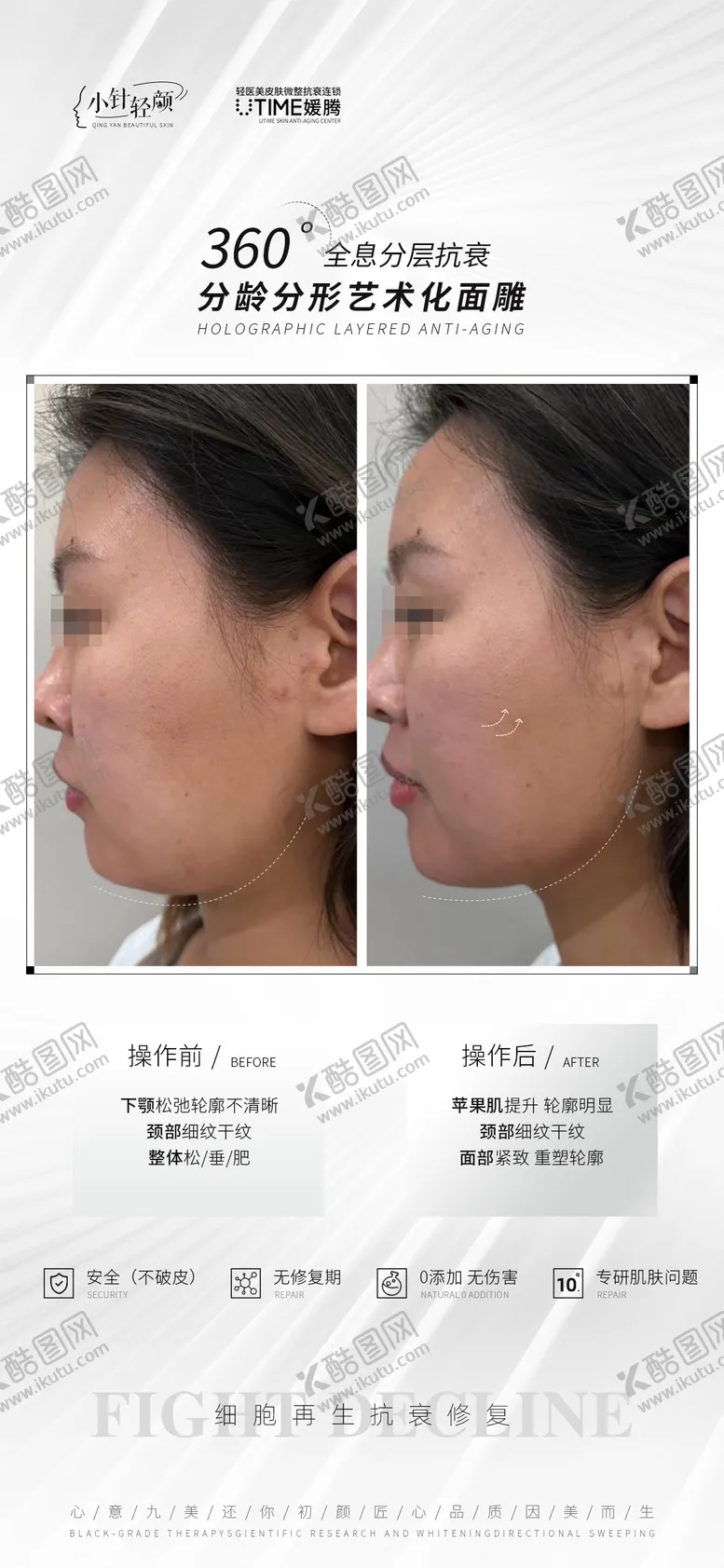 编号：32320011170104507321【酷图网】源文件下载-医美对比海报