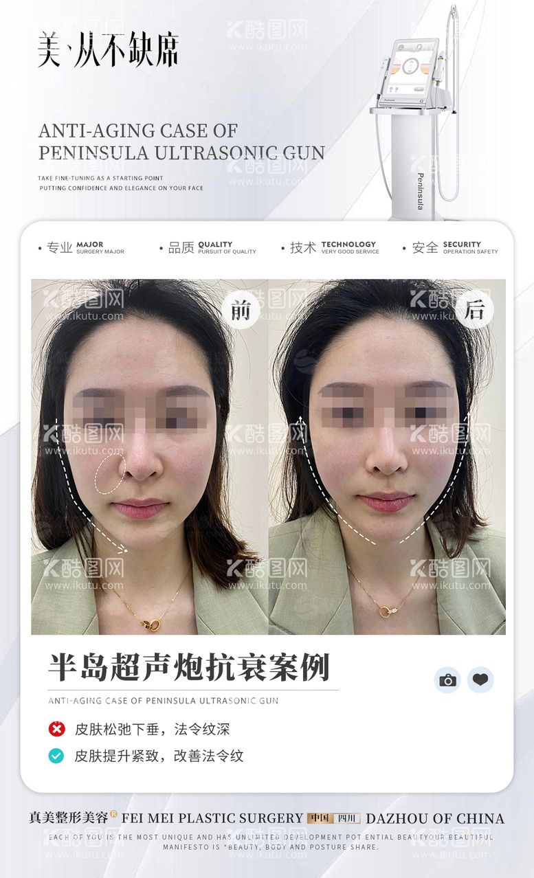 编号：89702012021233312027【酷图网】源文件下载-医美超声炮案例宣传海报