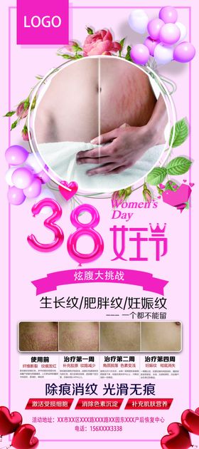 产后恢复去除妊娠纹展架