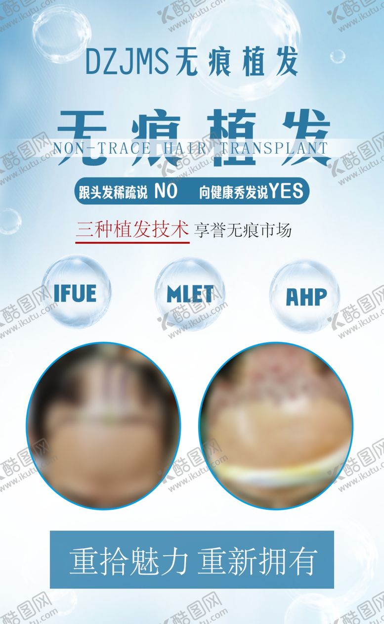 编号：30965805050643265030【酷图网】源文件下载-植发案例
