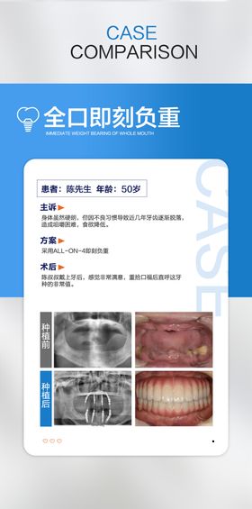 口腔案例合集海报