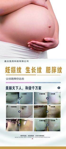 妊娠纹