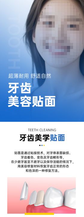 牙齿美白贴面