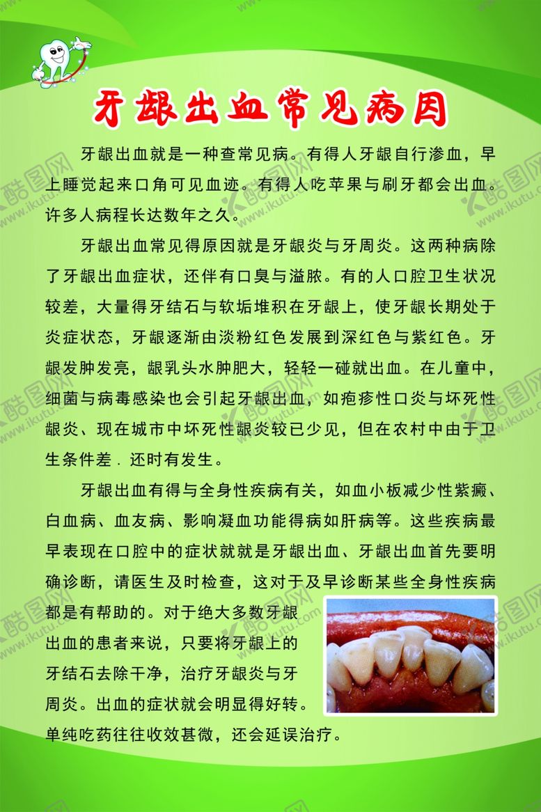 编号：21711503161512411763【酷图网】源文件下载-牙龈出血