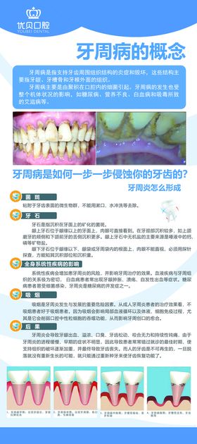 口腔科普易拉宝展架