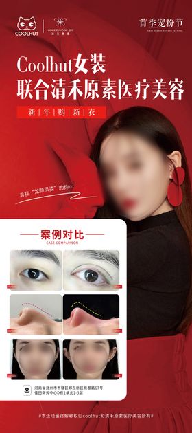 女装医美联合活动展架