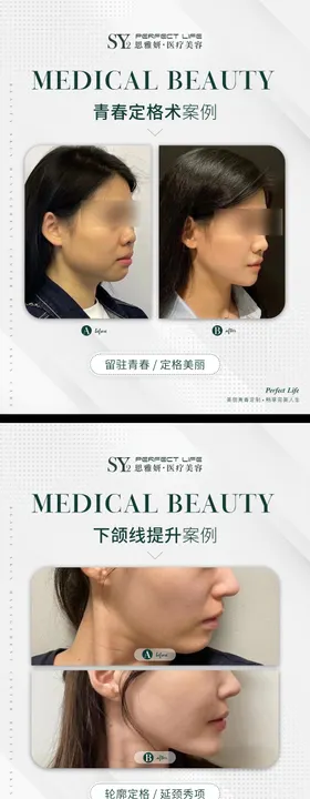 对比图标准格式医美对比图疗程对比