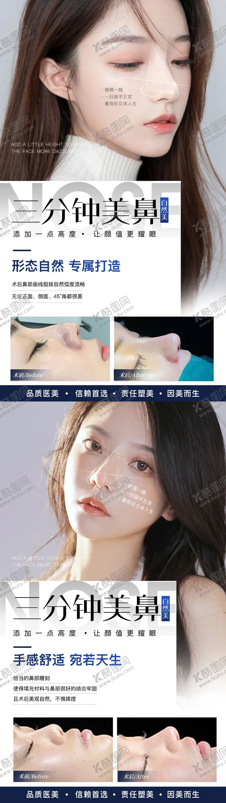 编号：57237411301700491338【酷图网】源文件下载-医美鼻综合案例系列海报