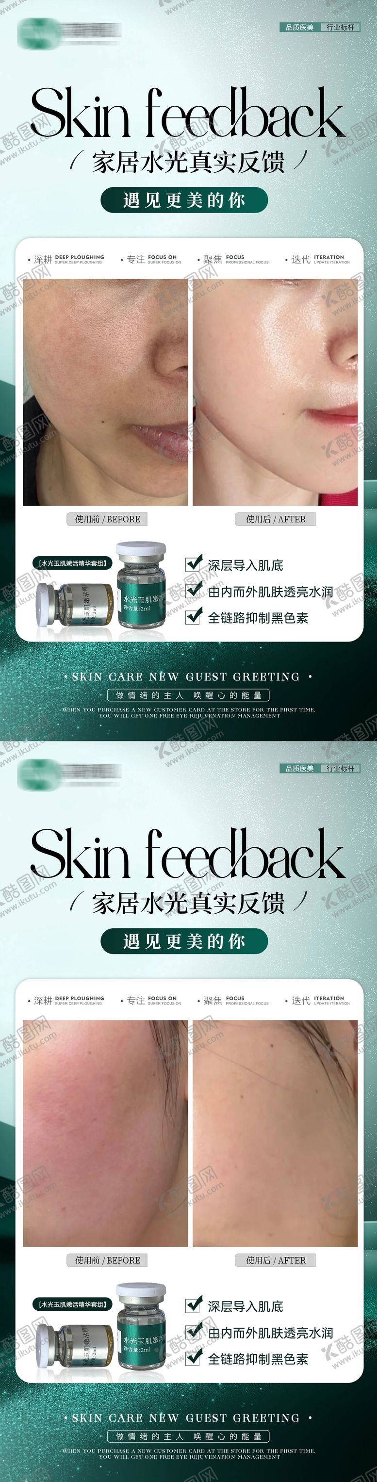 编号：35035009232220197904【酷图网】源文件下载-医美水光敏感肌案例系列海报