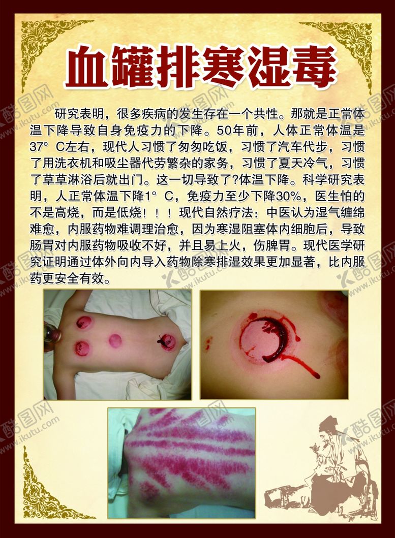 编号：33009106181758269196【酷图网】源文件下载-血罐排寒湿毒宣传板