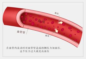 血管