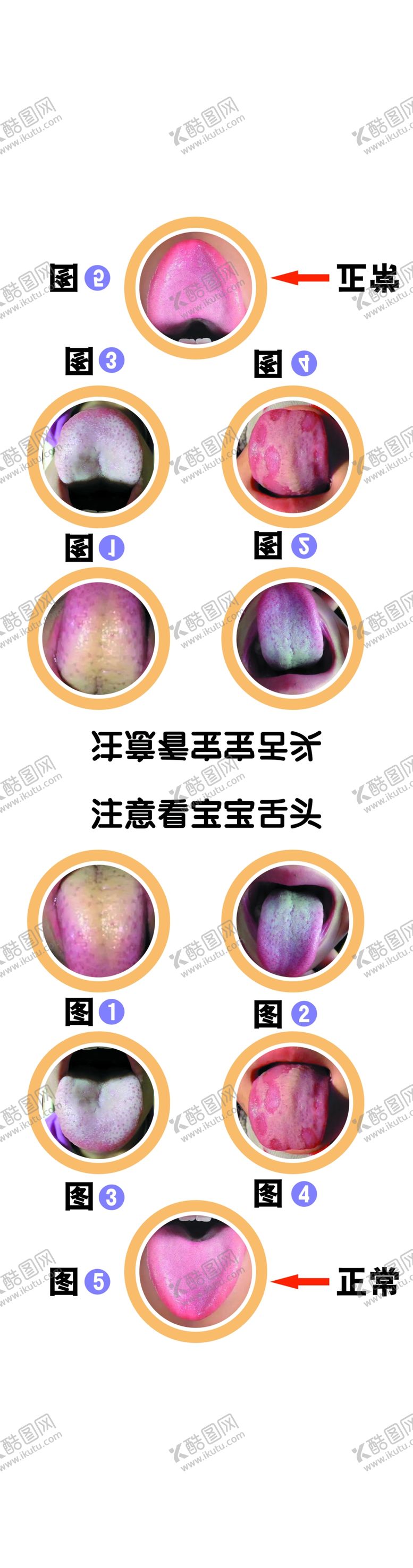编号：49571912191838329792【酷图网】源文件下载-舌苔三角板中医调理口腔问题