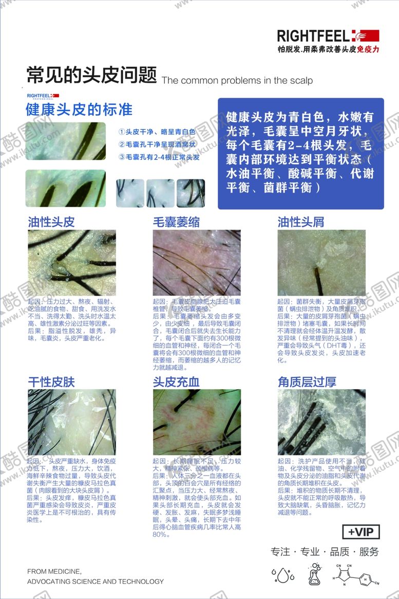 编号：16118102131802387826【酷图网】源文件下载-常见的头皮问题
