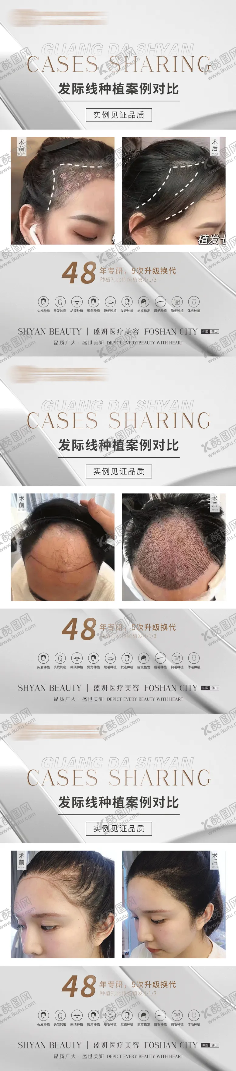 编号：61883011190457144264【酷图网】源文件下载-植发案例系列