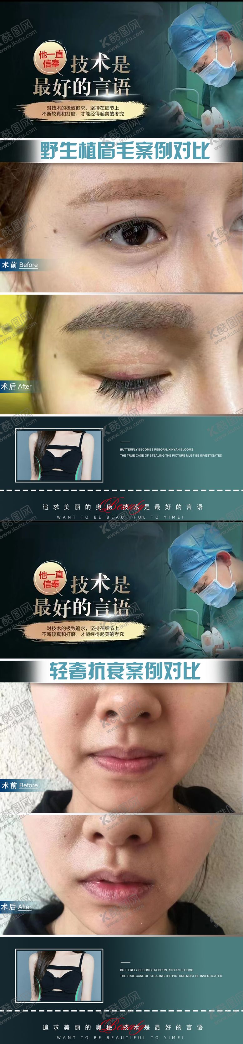 编号：69834708101244378602【酷图网】源文件下载-整形植发医生案例海报