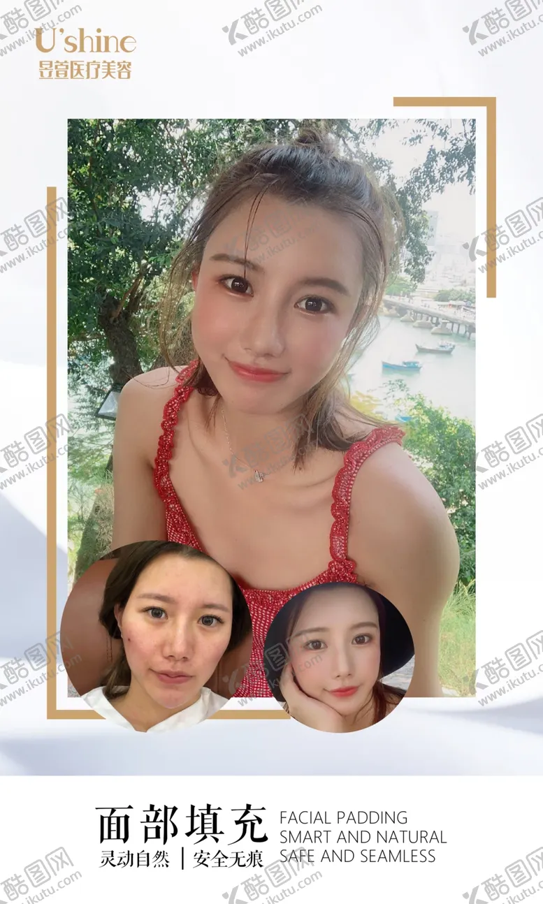 编号：51948105100404151733【酷图网】源文件下载-医美整形医院案例对比海报