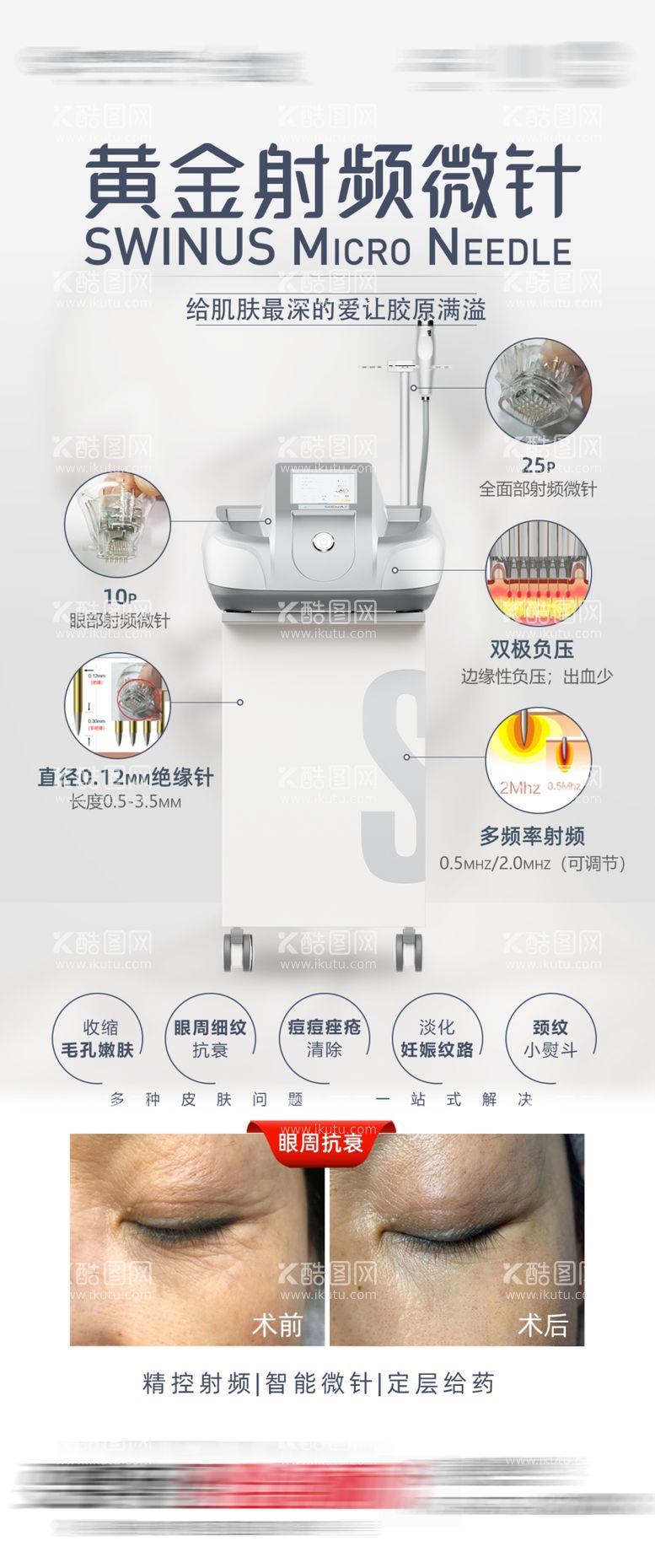 编号：63039912121428573906【酷图网】源文件下载-黄金射频微针