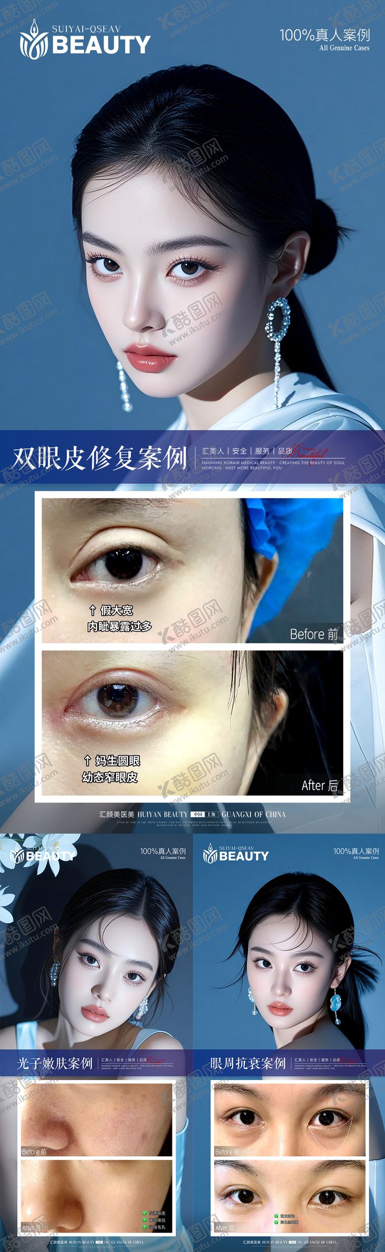 编号：91174303191414015164【酷图网】源文件下载-医美案例