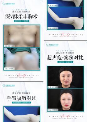 医美案例对比海报