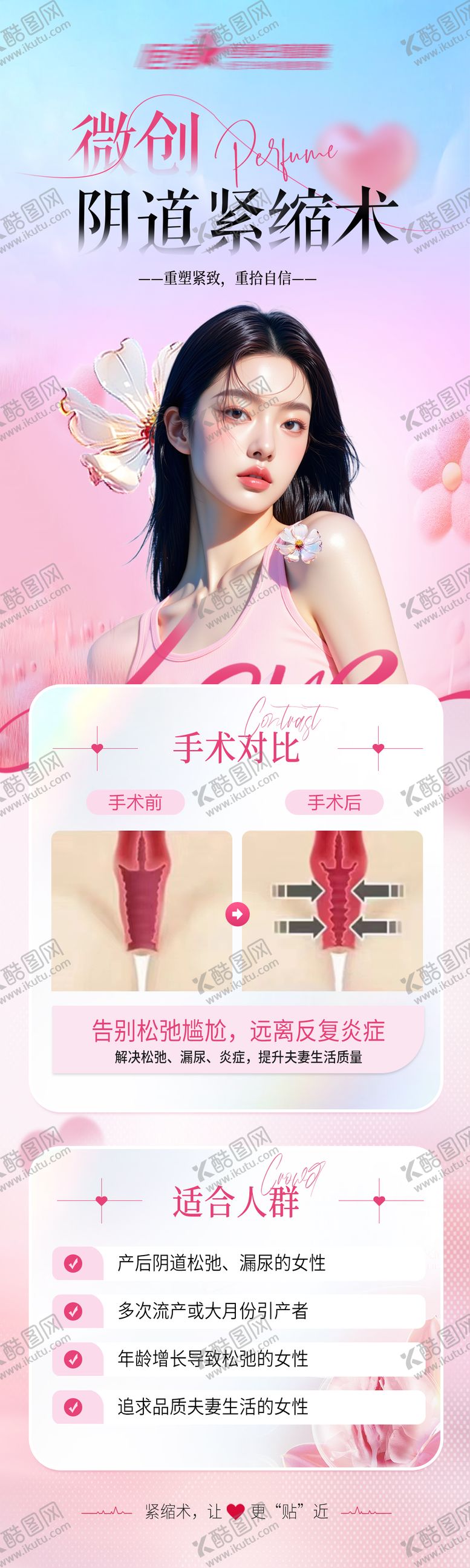 编号：79528709150425442816【酷图网】源文件下载-微创阴道紧缩术私密海报