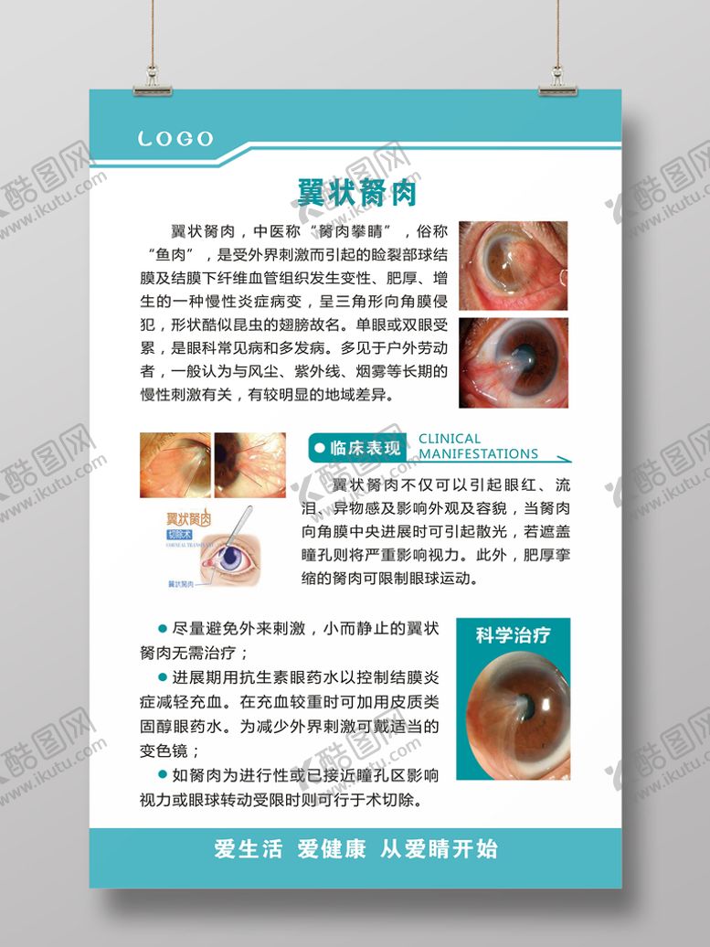 编号：43988612011548401011【酷图网】源文件下载-翼状胬肉