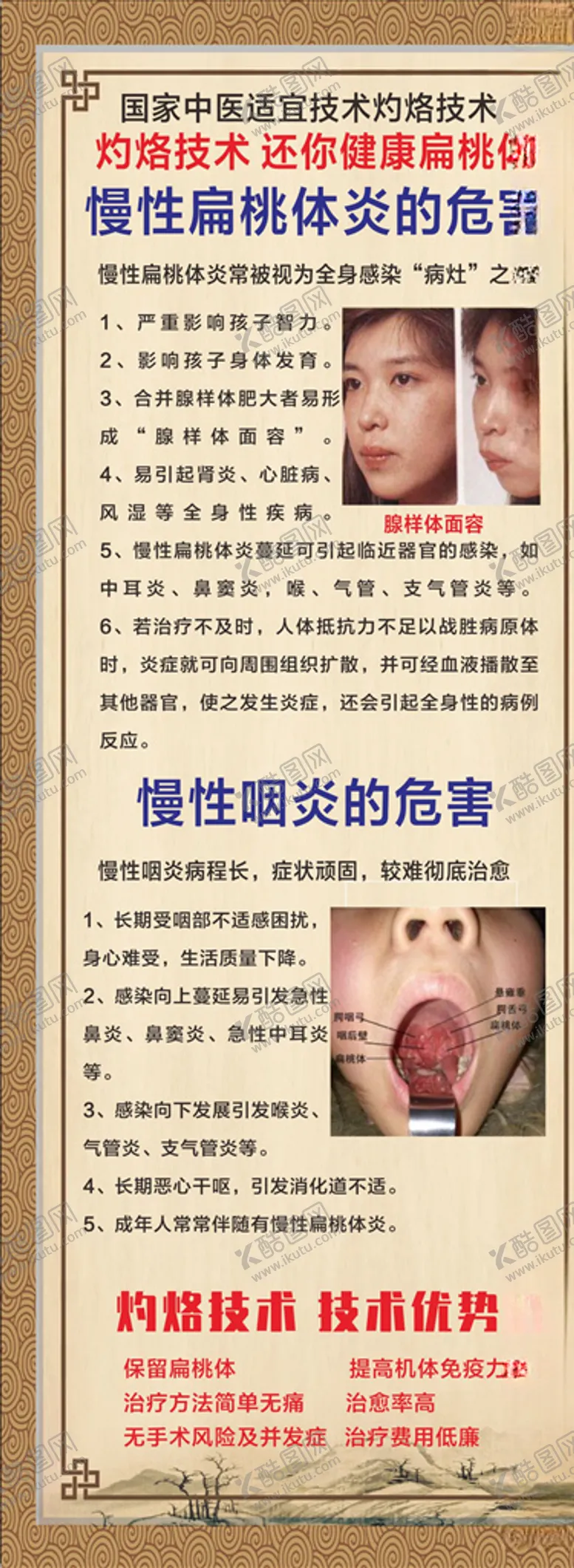 编号：72899904201327474947【酷图网】源文件下载-慢性扁桃体炎