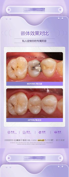 矫正案例海报模板前后对比海报